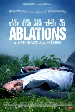 Affiche du film Ablations